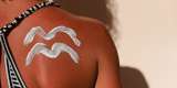 ¿Cómo recuperar la piel luego de quemarse con el sol? Expertas responden