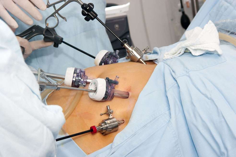Condenan al hospital el Tunal por falla médica. /123 rf