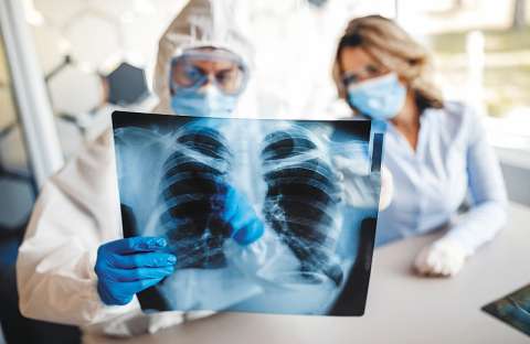 Las secuelas que deja el virus y el reto de recuperar la salud