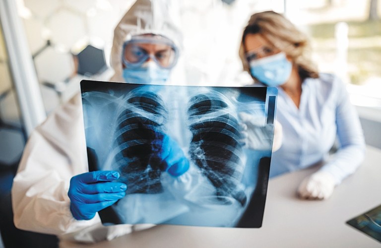 Las secuelas que deja el virus y el reto de recuperar la salud