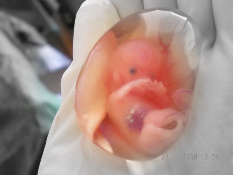 El cambio climático podría estar afectando la fertilidad de los seres humanos