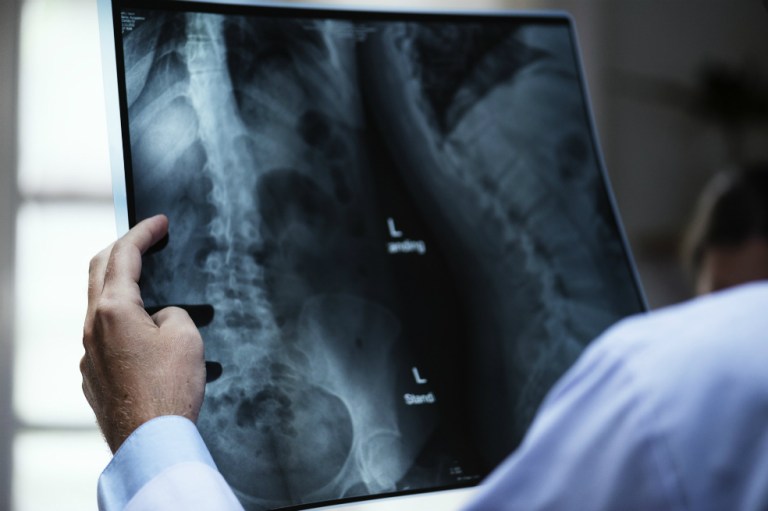 Johnson & Johnson, multada en EE.UU. por vender implantes engañosos