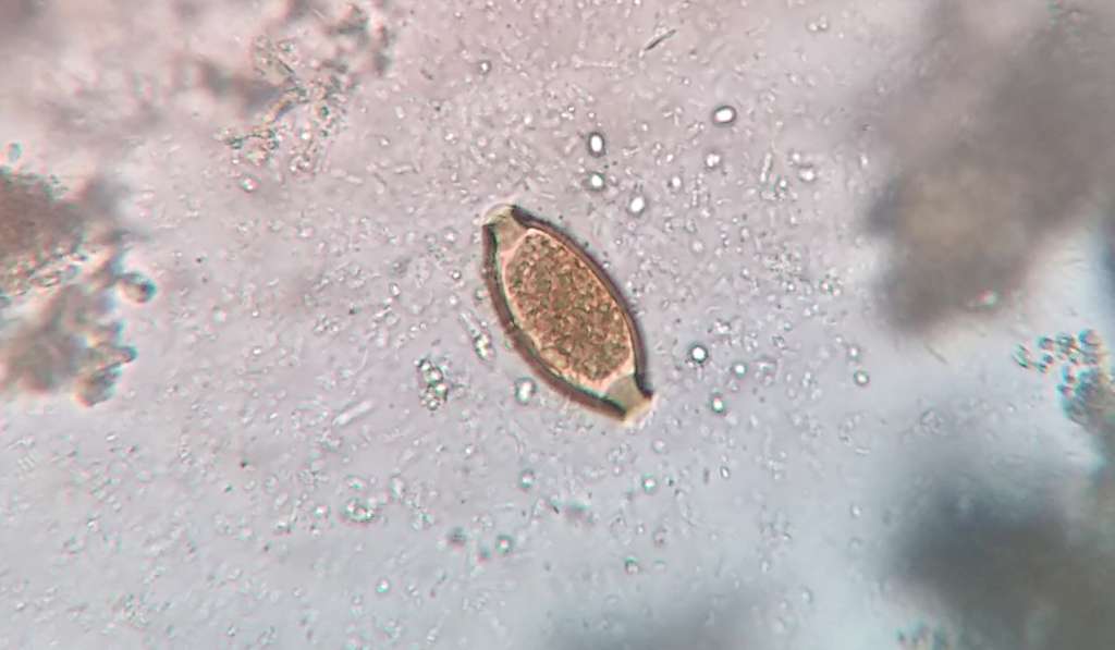Los huevos de Trichuris trichiura pueden permanecer vivos hasta 10 años esperando un huésped donde eclosionar.