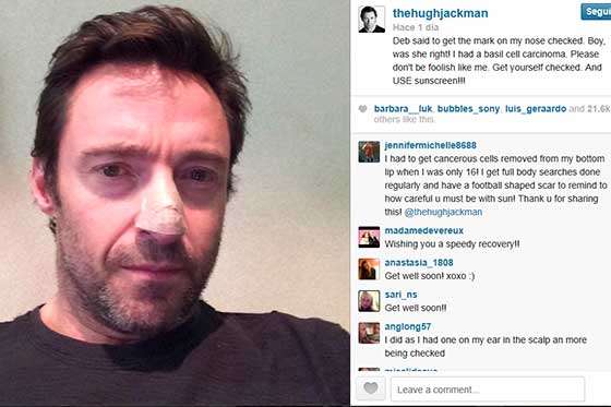 El actor Hugh Jackman tiene cáncer de piel