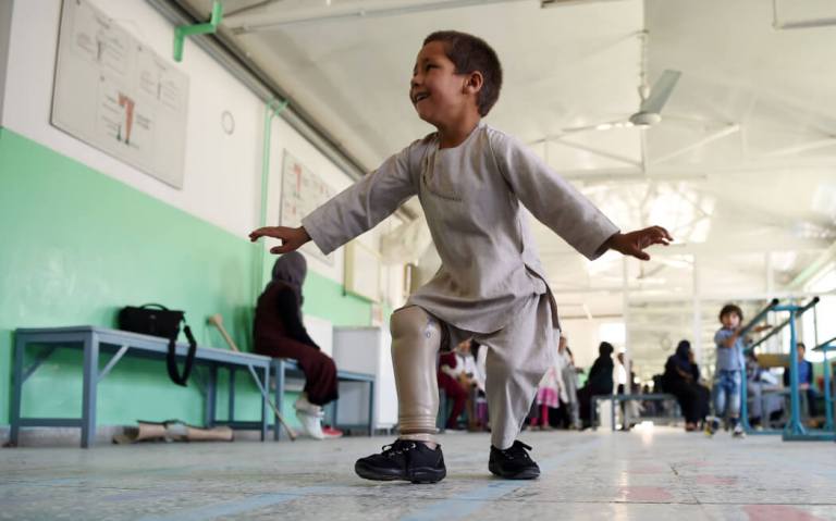 La alegría de un niño amputado que baila con su pierna nueva conmueve a Afganistán