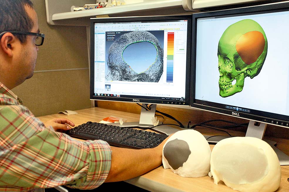 El año pasado sobresalió en las noticias científicas de Medellín el trabajo de la empresa SmartBone, que diseña y comercializa implantes para sobrevivientes de fracturas en el cráneo. / Robinson Henao