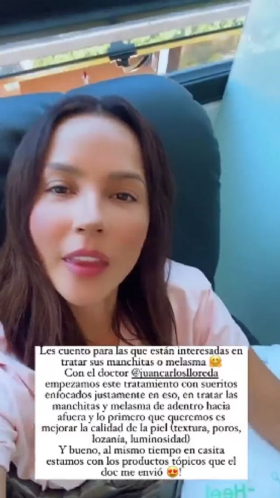 Carmen Villalobos padece melasma: ¿de qué se trata esta enfermedad?