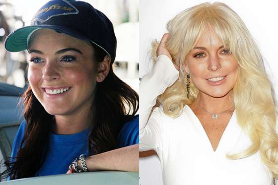 ¿Adictas a las cirugías plásticas? Desde Liza Minelli a Lindsay Lohan