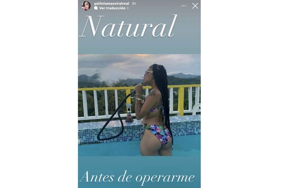 ‘Yailin, la más viral’, quien se robó el corazón de Anuel, ex de Karol G, ha tenido un impresionante cambio físico a lo largo de los años.