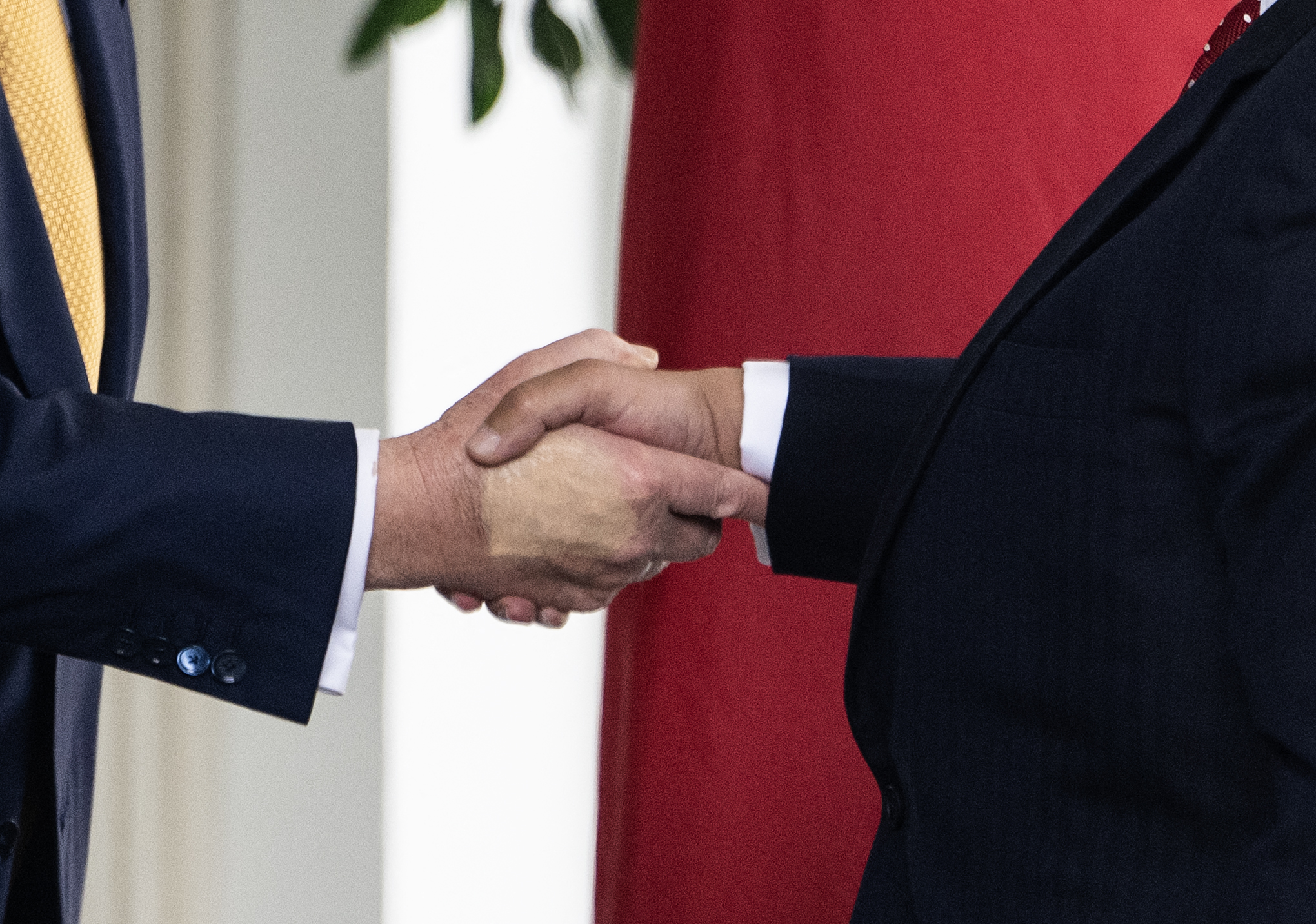 Al presidente Donald Trump le diagnosticaron insuficiencia venosa crónica.