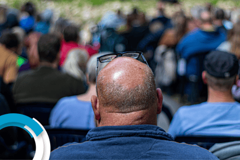 Consejos para prevenir la alopecia areata