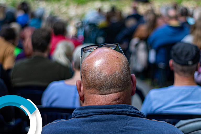 Consejos para prevenir la alopecia areata