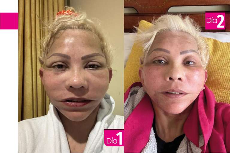 Así fue la transformación de la gorda Fabiola