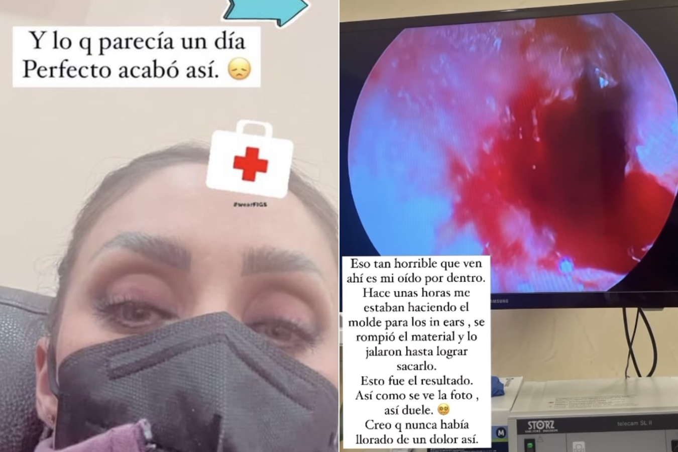 Historias de la cuenta de Instagram de Anahí mostrando el accidente en su oído.