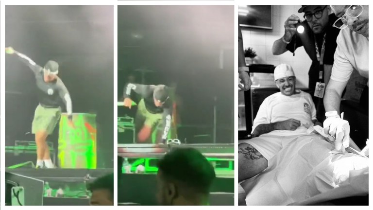Feid sufrió fuerte caída en concierto en Madrid y le tuvieron que coger puntos