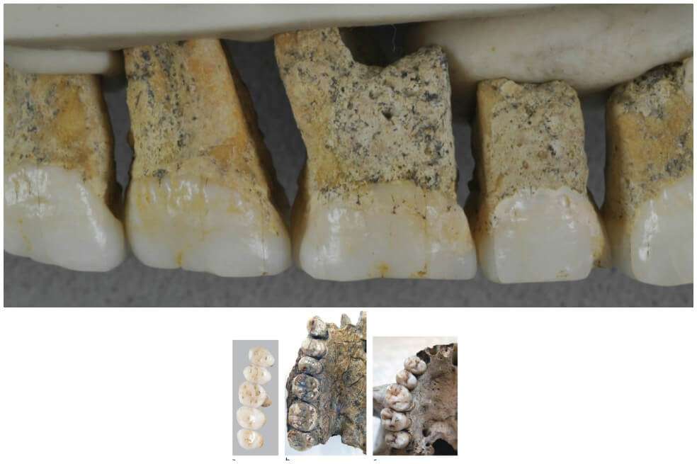 Dentadura del Homo luzonensis. / / © Callao Cave Archaelogy Projet