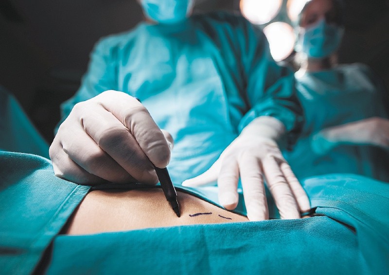 Close up of a plastic surgeon marking the human skin for surgery.