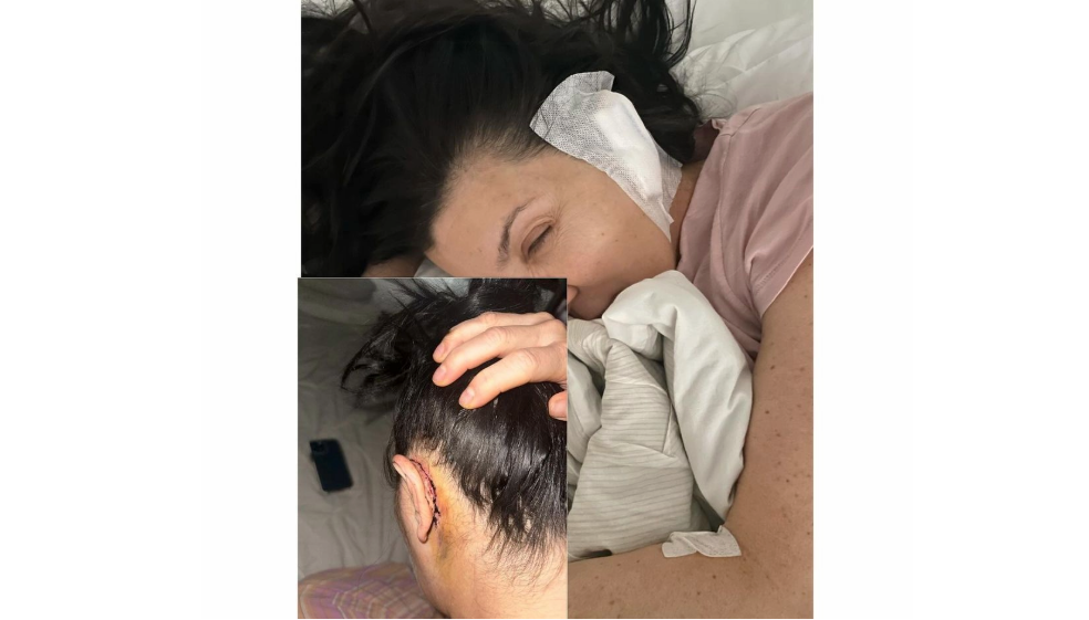 “Me despegaron la oreja”: Isabella Santodomingo se someterá a nueva cirugía
