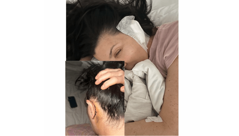 “Me despegaron la oreja”: Isabella Santodomingo se someterá a nueva cirugía