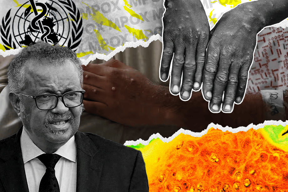 La preocupación por la propagación de mpox es latente.