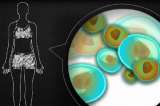 Rehabilitarse en casa puede resultar más efectivo para personas con esclerosis múltiple
