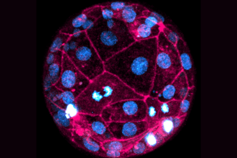 Esta es la imagen más nítida que se conoce del embrión vivo de un humano