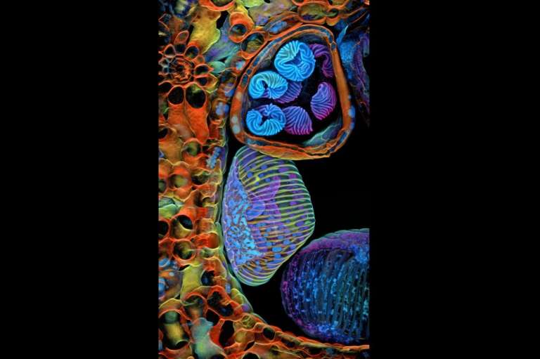 Dr. Igor Siwanowicz se quedó con el quinto lugar de la competencia. Su imagen es la de unas esporas (estructuras azules/violetas) de un pequeño helecho tropical (Ceratopteris richardii), las cuales son ampliamente estudiadas para comprender la evolución de las plantas.