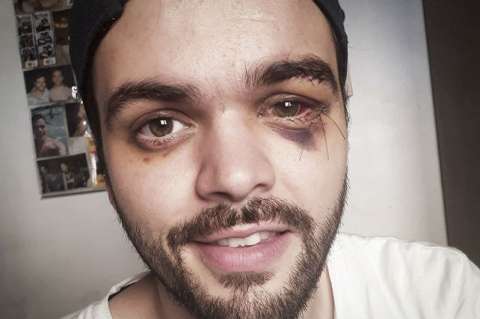 "No te calles, no seas cómplice": carta del jugador de rugby golpeado por ser gay