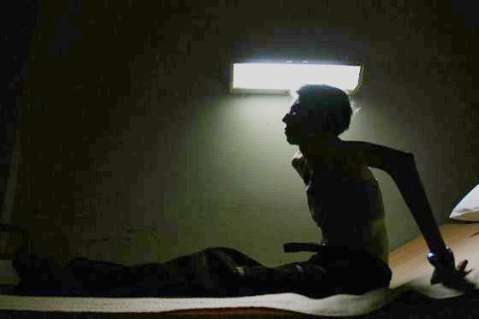 La anorexia es la enfermedad mental más mortal