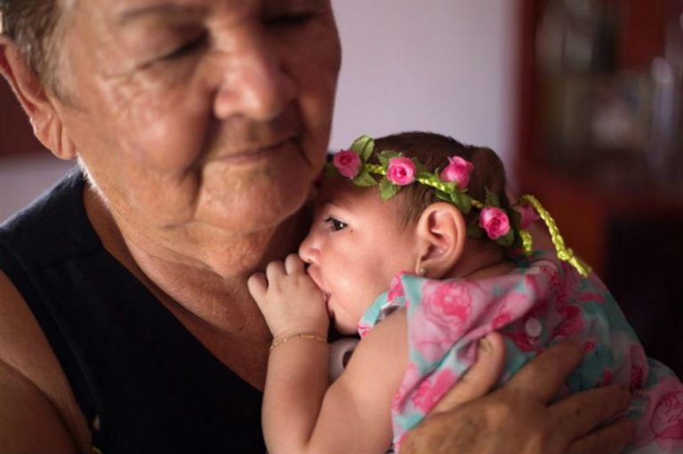 Si se prueba vínculo de zika con microcefalia o Guillain Barré, consecuencias serán impactantes