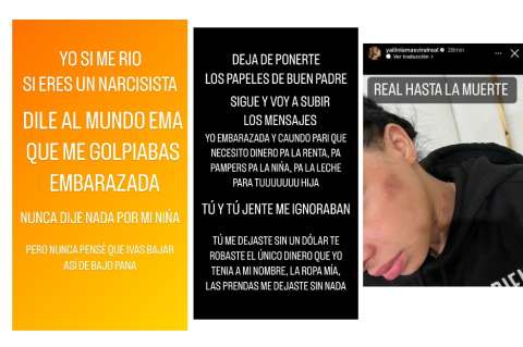 ¿Qué pasó con Anuel y Yailin? Con una foto ella lo denunció por maltrato