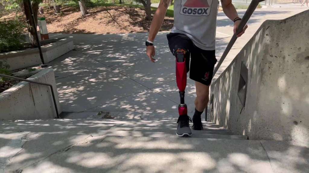 Persona usando la Utah Bionic Leg.