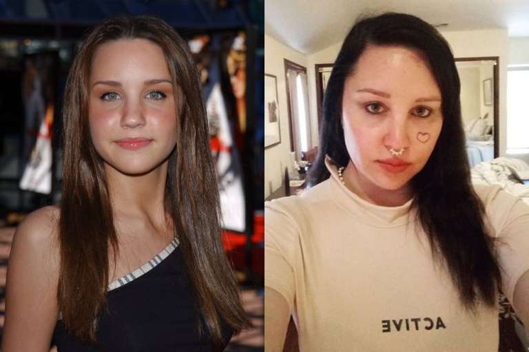 Con solo trece años, Amanda Bynes obtuvo su primer protagónico en la televisión estadounidense. Así luce actualmente.