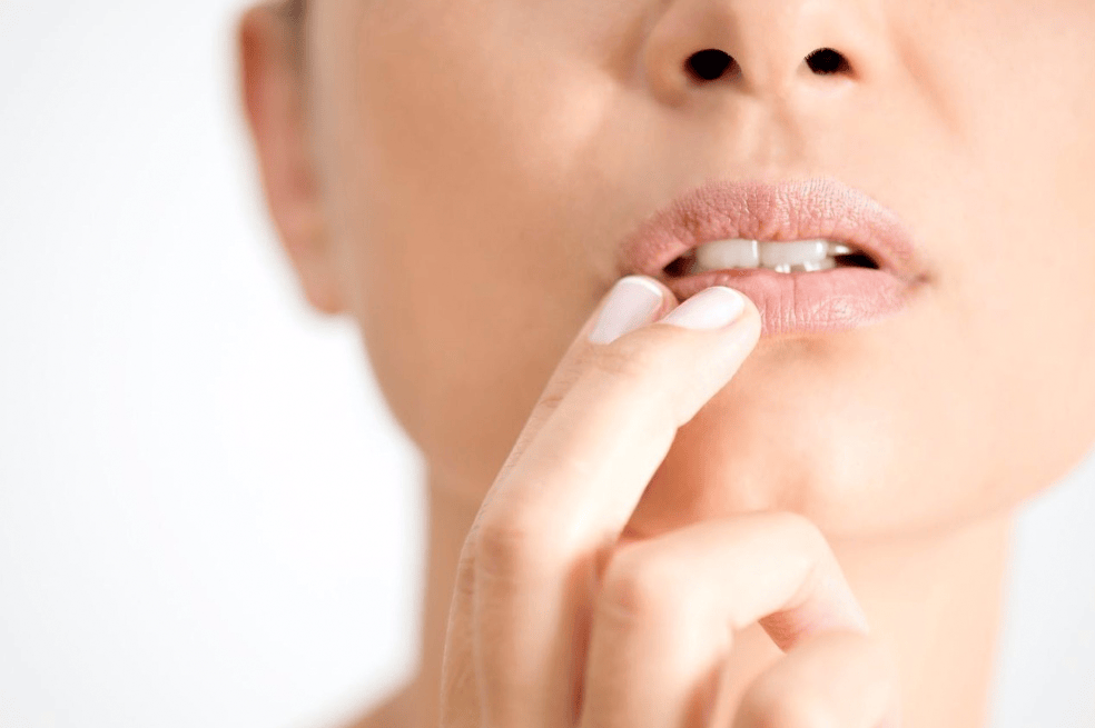 claves para cuidar el herpes labial