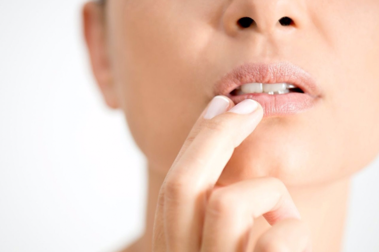Herpes labial no es tan antiguo como se creía: diente de hace 14 siglos da pistas