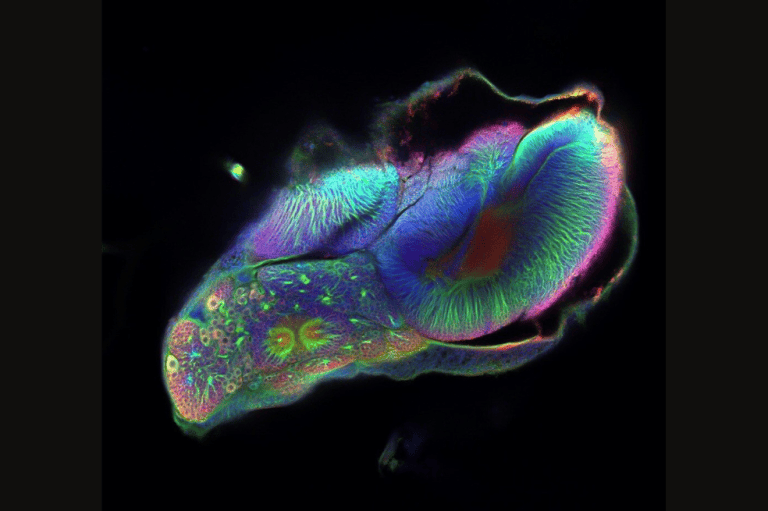 Este es el cerebro de una mariposa en metamorfosis. Durante la metamorfosis, nacen nuevas neuronas mediante un proceso llamado neurogénesis. La neurogénesis ocurre en muchas especies durante el desarrollo y la edad adulta, y su estudio puede proporcionar información valiosa sobre cómo se forma el sistema nervioso. Las interrupciones en este proceso pueden provocar trastornos y deterioro cerebral. Amaia Alcalde Anton, bióloga de la Universidad de Bristol, tomó la imagen y declaró: «Al explorar la diversidad cerebral en animales como moscas o mariposas, podemos profundizar nuestra comprensión de la diversidad cerebral y los procesos fundamentales que la configuran».