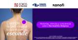 Impacto de la dermatitis atópica: consecuencias físicas y emocionales