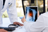 Aumentan los casos de cáncer de pulmón entre los no fumadores