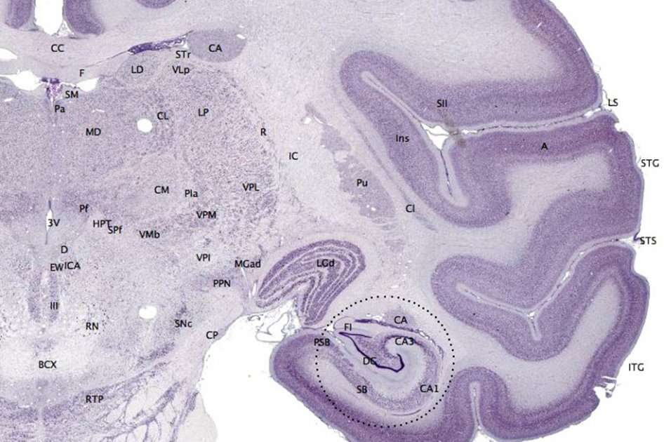 Neuronas en el cortex o capa superficial del cerebro de un mono.