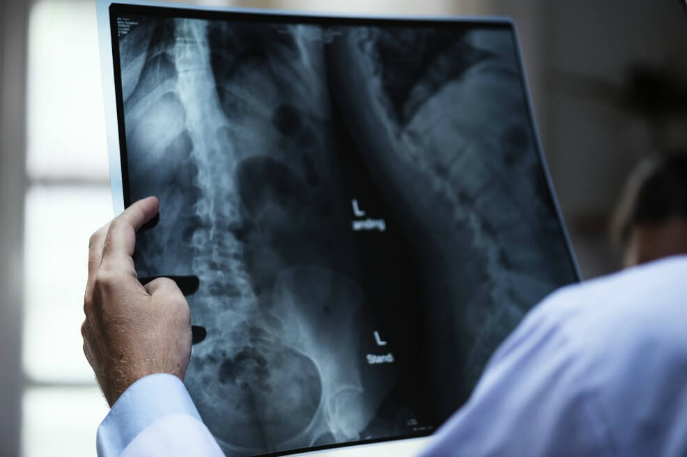 Las muertes causadas por el cáncer de próstata descendieron en 14 países estudiados y se mantuvieron estables en 54. / Pixabay