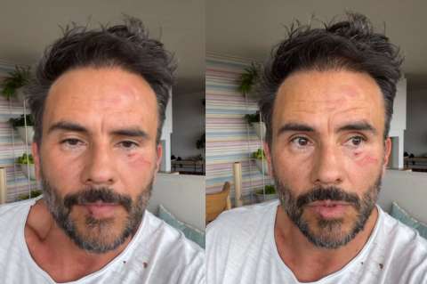 Juan Pablo Raba víctima de robo en Bogotá: “Le dieron puños, los niños asustados”