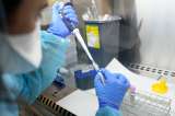 Tras confirmar caso de viruela símica en Bogotá ¿qué hacer para protegerse?