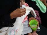 Yemen: cinco razones por las que la desnutrición infantil aguda está aumentando