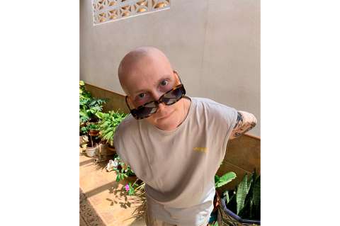 Murió Charlie, el tiktoker que sufría de cáncer y relataba sus días en su perfil