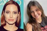 Laura Rodríguez, Angelina Jolie y otros famosos que sufrieron parálisis facial