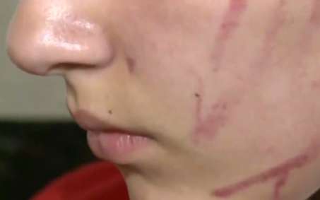 Padre e hija fueron víctimas de matoneo escolar en Bosa