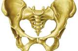Exitoso trasplante de pelvis creada con una impresora 3D