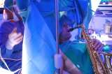Video: este hombre tocó el saxofón mientras le extraían un tumor del cerebro