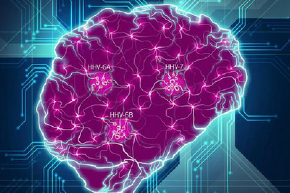 El cerebro se muestra como una red compleja de interacciones, con la interrupción de las conexiones por las especies virales clave (HHV-6A, HHV-6B, HHV-7) identificadas en este estudio. / Readhead et al. /Agencia Sinc