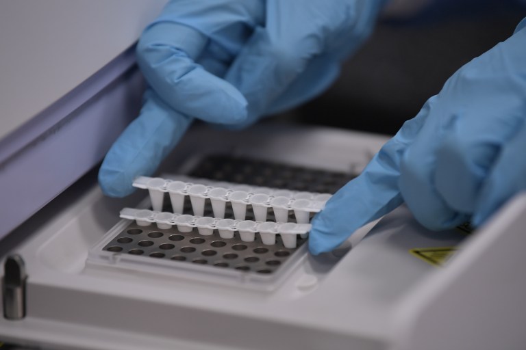 Autorizan estudio clínico con terapia génica para la atrofia muscular espinal